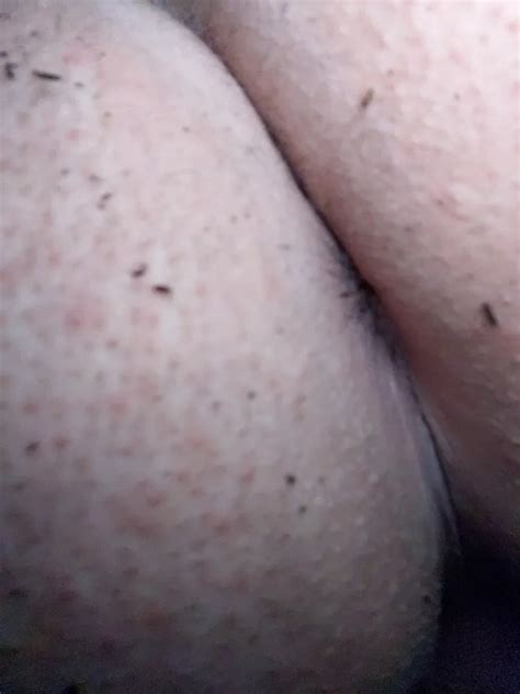 Outdoor Pictures 1 Late Night Jerking 28 Nude Pics XHamster