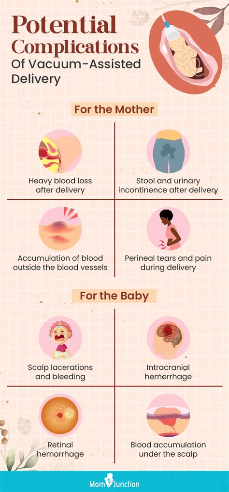 What Is Vacuum Assisted Delivery? Its Procedure & Alternatives