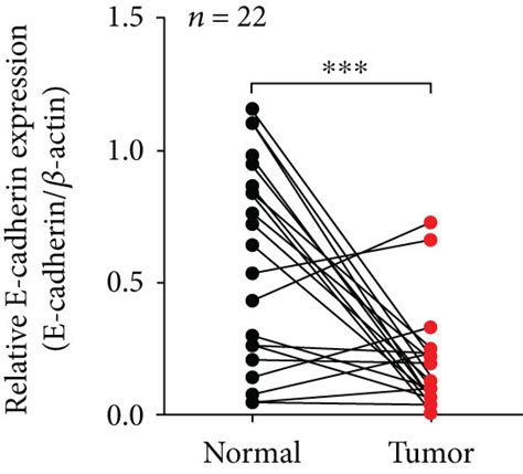 Mir P Inhibited Growth And Metastasis Of Lung Adenocarcinoma Cells