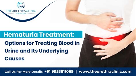 Hematuria Treatment: Effective Care for Blood in Urine