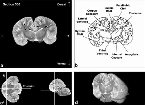 Anatomy And Three‐dimensional Reconstructions Of The Brain Of A