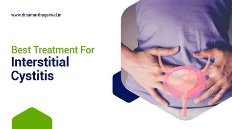 Best Treatment For Interstitial Cystitis - Dr Samarth Agarwal