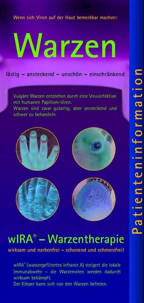 PDF Wenn sich Viren auf der Haut bemerkbar machen Warzen¼r I Wenn