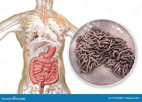 Vermes Parasit Rios No Intestino Humano Ilustra O Stock Ilustra O