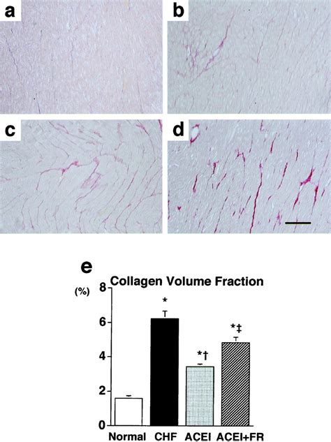 Bradykinin Improves Left Ventricular Diastolic Function Under Long Term