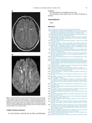 Fat Embolism Syndrome State Of The Art Review Focused On PDF