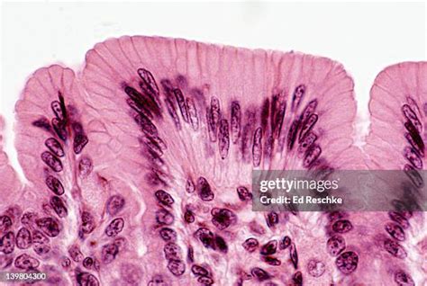 107 Simple Columnar Epithelium Stock Photos High Res Pictures And