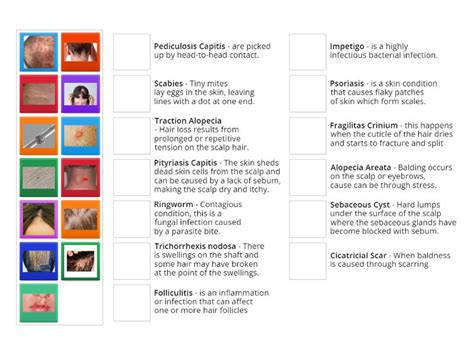 Hair and scalp conditions - Symtoms - Match up