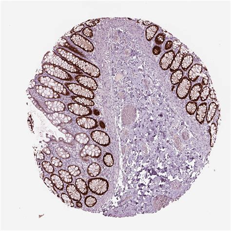 Tissue Expression Of SOX9 Staining In Colon The Human Protein Atlas