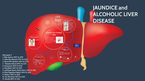 JAUNDICE and ALCOHOLIC LIVER DISEASE by Nurul Fitri Syahrir on Prezi