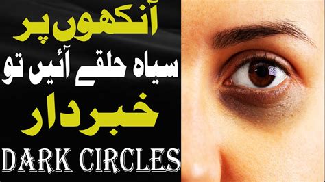 Aankhon Ke Niche Halke Ilaj Dark Circles Treatment Of Eye Circles