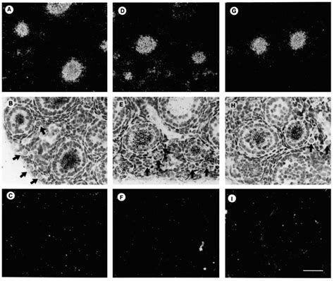 In Situ Hybridization Of Mouse Ovaries Higher Magnification