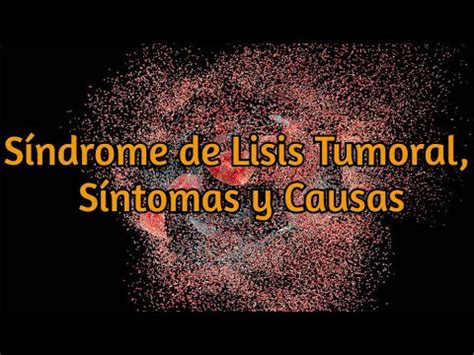 Síndrome de Lisis Tumoral Síntomas y Causas YouTube