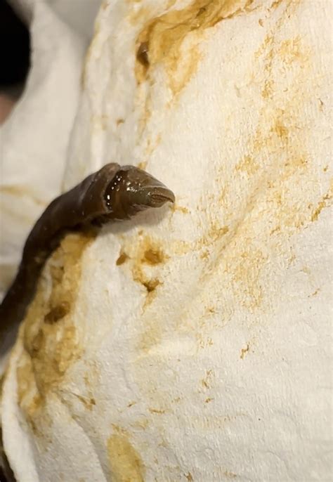 (pg 257, 357) nausea, fatigue, vomitting, dizziness, pain in muscles