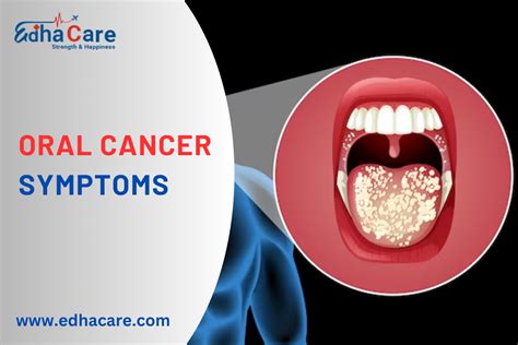 Recognize Oral Cancer Symptoms - A Guide By EdhaCare