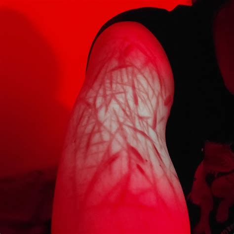 My Arms Under Blacklight : r/scars