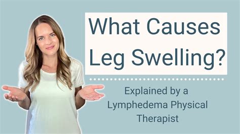 Causes Of Leg Swelling Ankle Edema And Swollen Feet Youtube