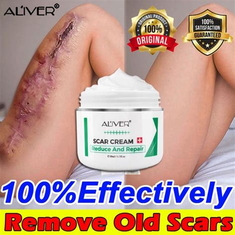 【100 Effective】original Aliver Peklat Remover Cream For Old Peklat