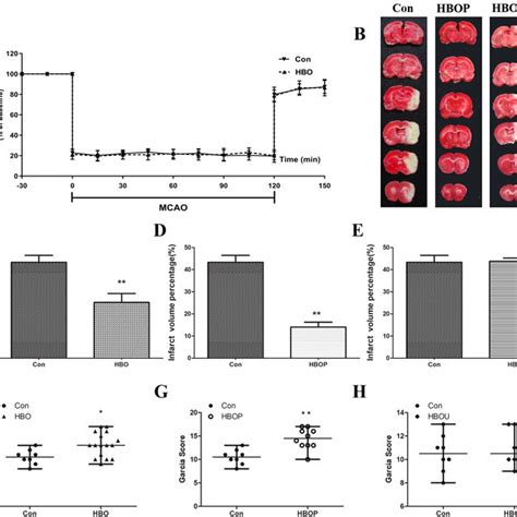 Regional Cerebral Blood Flows Infarction Volume And Neurological