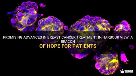 Promising Advances In Breast Cancer Treatment In Harbour View A Beacon Of Hope For Patients