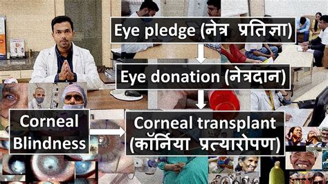 Eye Pledge To Corneal Transplant What Happens In Between Awareness