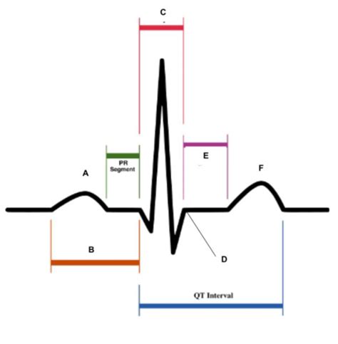 Interpreting Ekgs Flashcards Quizlet