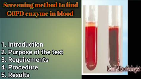 Screening Method Of G6PD Enzyme Blood Test Lecture 3 YouTube