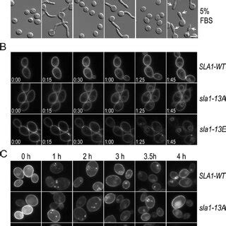 Defects Of The Sla Mutant A Morphology Of Sla Yeast