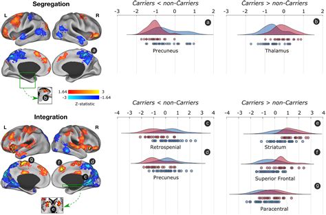 Amyloid β and tau pathologies relate to distinctive brain