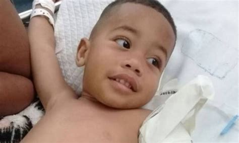 Menino De 2 Anos Atingido Em Tiroteio Na Zona Norte Do Rio Pode Perder