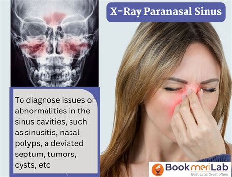 X-Ray PNS: Cost, Purpose, Procedure, Result [2025]