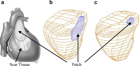 Figure 4 From In Vivo MRI Based 3D FSI RV LV Models For Human Right