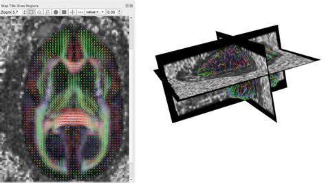 Dwi Marmoset Brain Connectivity Brain Minds