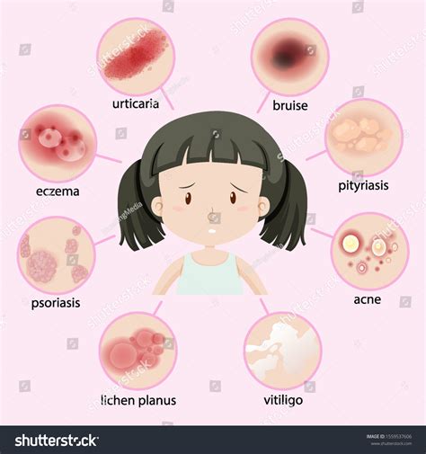 3 Child Bruise Diagram Images, Stock Photos & Vectors | Shutterstock