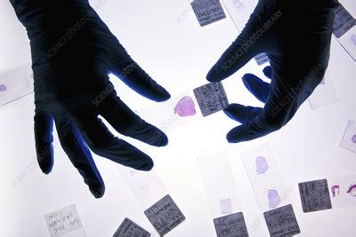 Histology Tissue Sample Preparation Stock Image C Science