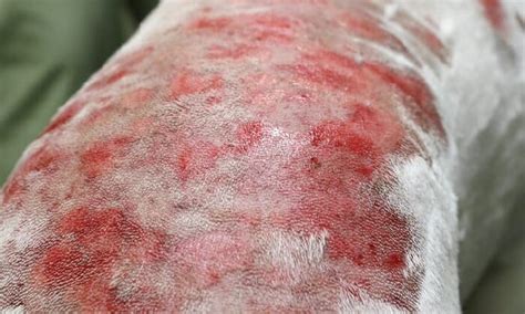 Skin Lesions On Dogs