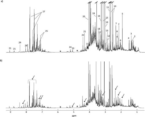 Average 1 H NMR Spectra Of Urine Samples From A Controls And B RCC