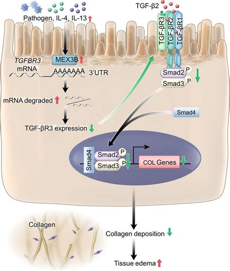 JCI Insight MEX3B Inhibits Collagen Production In Eosinophilic Nasal