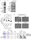 JCI HIF 2α expression and metabolic signaling require ACSS2 in clear