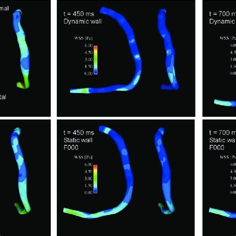 Instantaneous Wall Shear Stress Wss Contours On The Luminal Surface