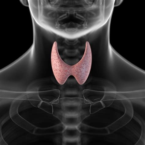 Treatment Of Hypothyroidism