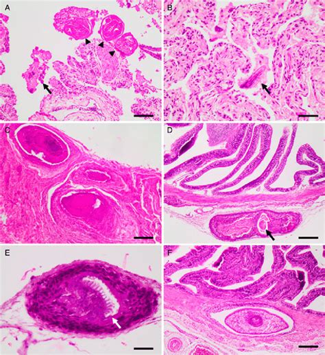 Histological Sections Showing A Lung With Adults Arrow Heads And Download Scientific