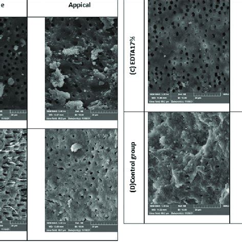 Scanning Electron Microscope Photographs At Showing Root Samples