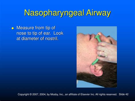 Nasal Airway Sizing