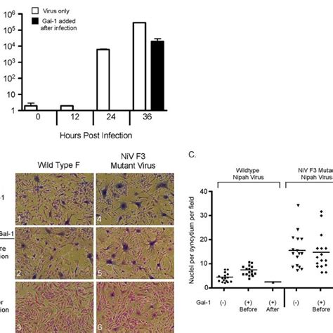 Galectin-1 can have opposing effects on Nipah virus production and ...