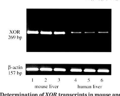 Figure 1 from Repressed Expression of the Human Xanthine Oxidoreductase Gene | Semantic Scholar