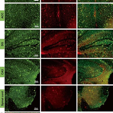 Microglia Accumulating Around A Plaques In The Brain And Spinal