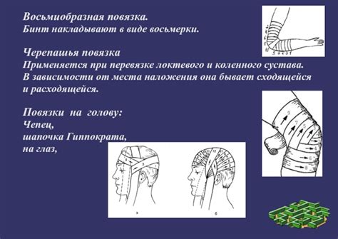 Повязки презентация, доклад