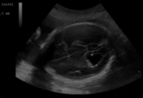 ultrasound - Harley Street Cardiology