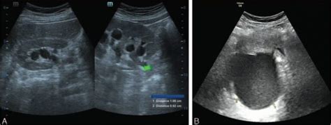 Ultrasound Sonography Concise Medical Knowledge